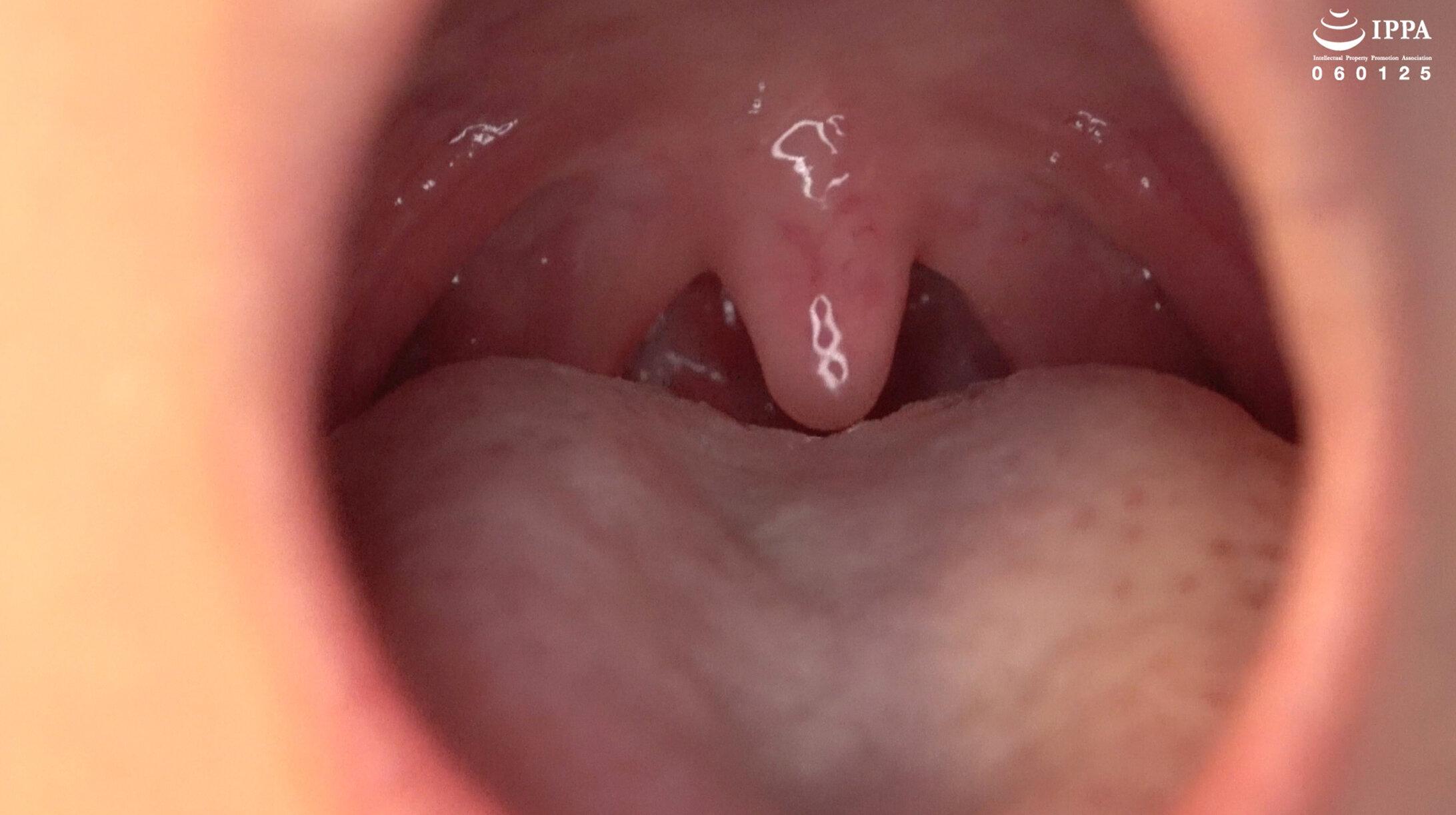 「素人モデルの超激レアな口内・歯・歯抜け・のどちんこ観察プレイ！」素人美女ナナ